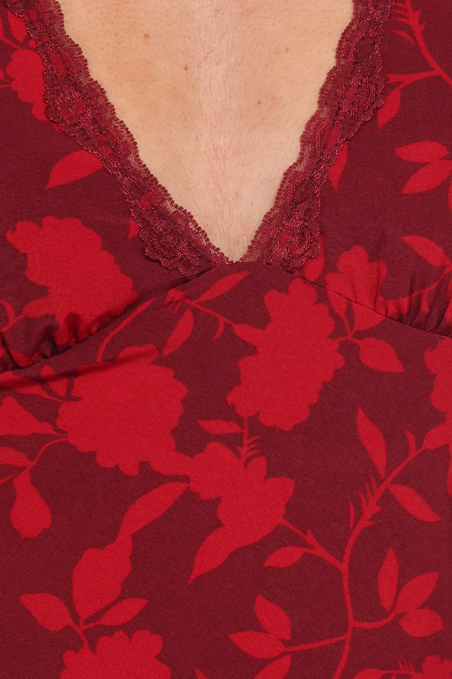 Kelso Top